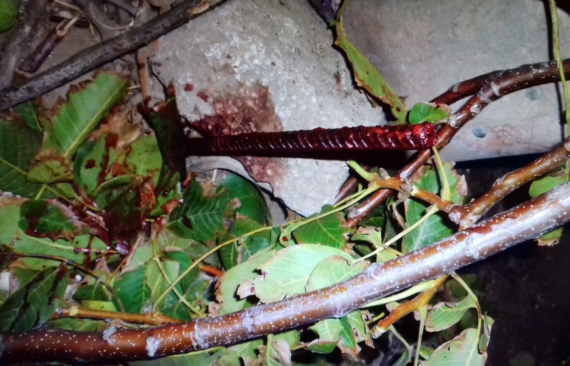 Ставрополец погиб, упав на прут во время обрезания веток деревьев. Фото