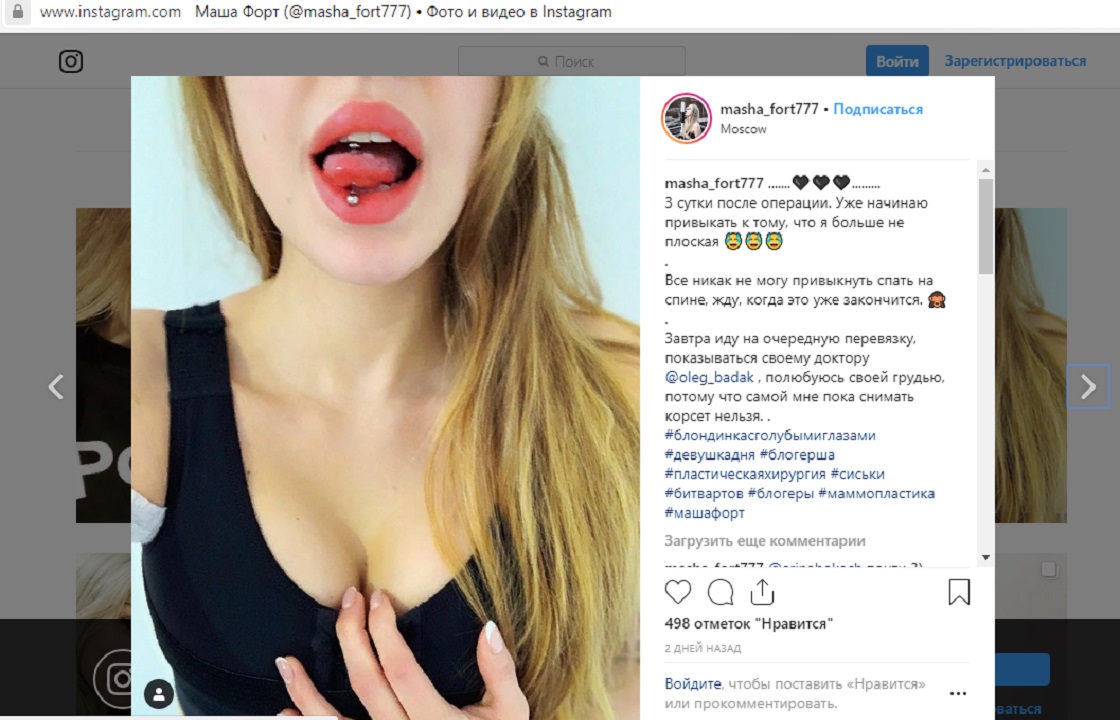 Выигравшая новую грудь девушка из Ростова показала результат. Фото 18+