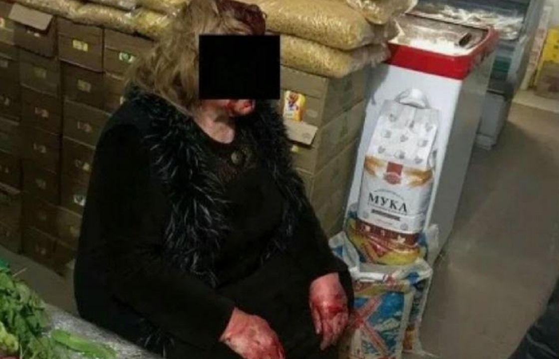 Бандиты в масках избили битами кассира сельского супермаркета в Дагестане. Фото