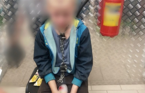Школьник на Кубани сидел на цепи, пока семья ездила в другой город. Фото 18+