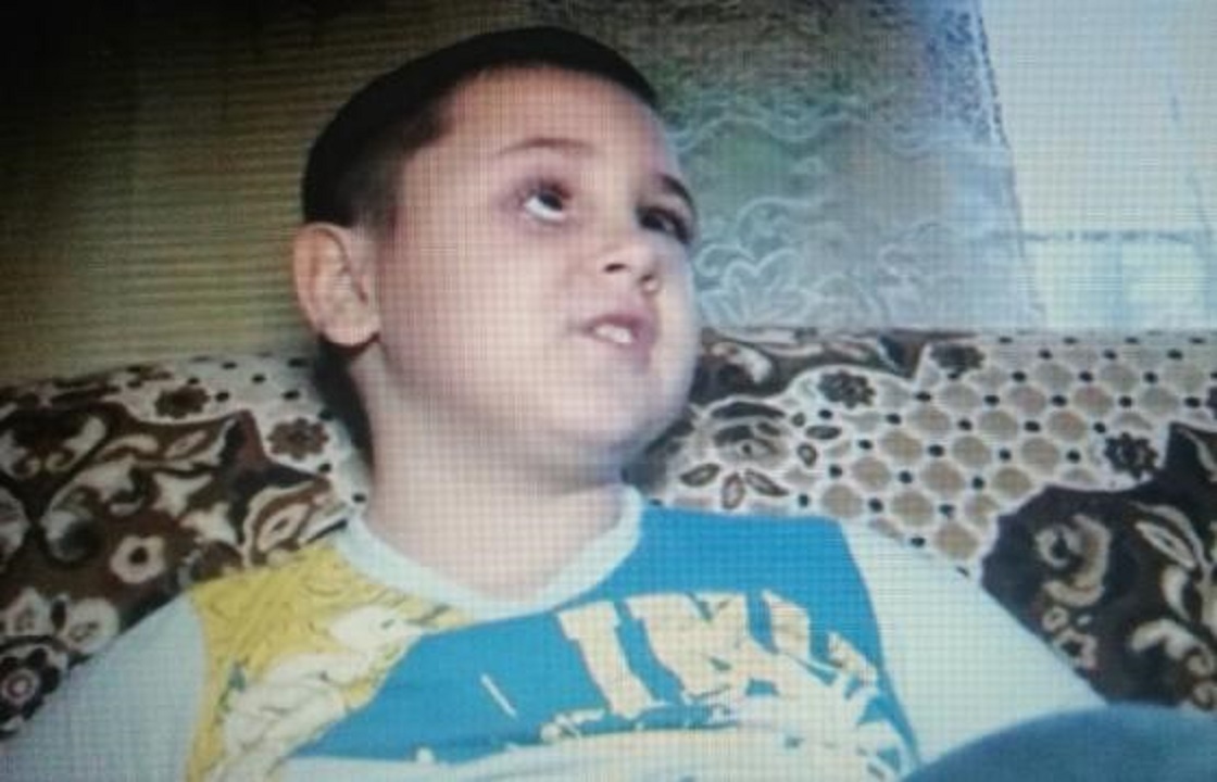 У него нет глаза. Косоглазие глаза. Скотч для глаз. У него нет глаза. У него нет глаза.