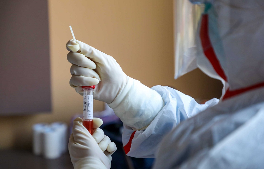 Первое подозрение на коронвирус зафиксировано в Адыгее