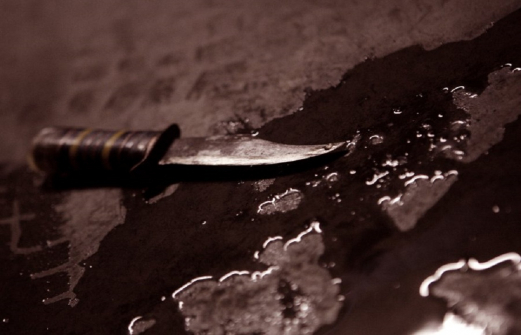 В Черкесске преступник напал с ножом на полицейского