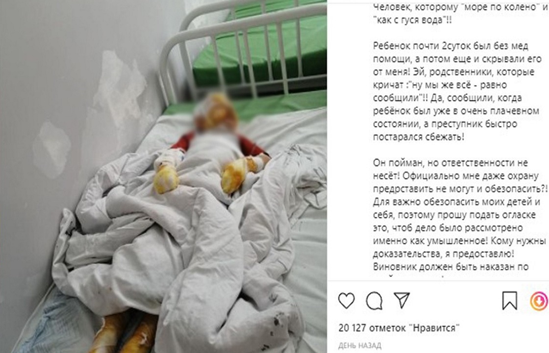 Жительница Крыма заявила, что экс-муж из мести сжег ребенка. Подробности