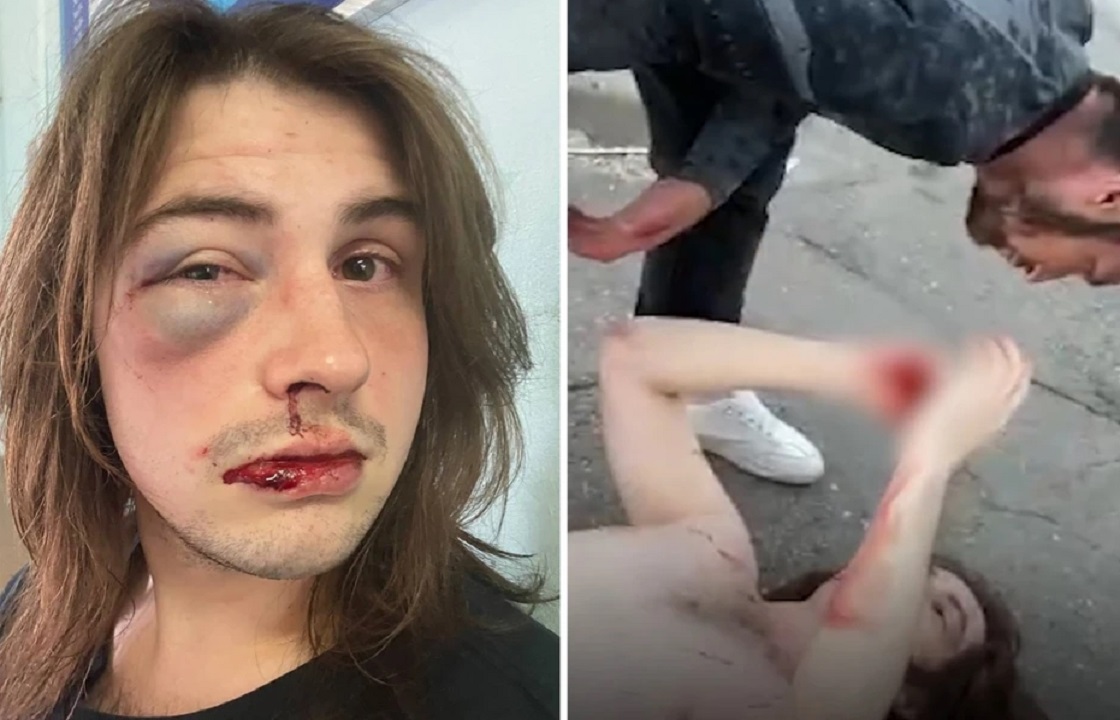 Туриста из Екатеринбурга избили в Сочи из-за длинных волос
